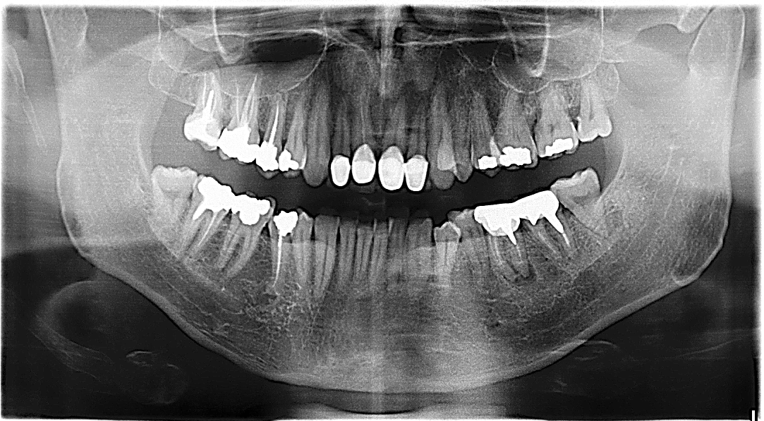 layer-dental-default